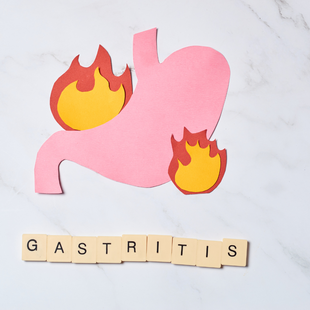 Gastritis. Safe, Long Term & Natural Solutions.